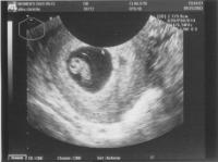 Katie's Ultrasounds