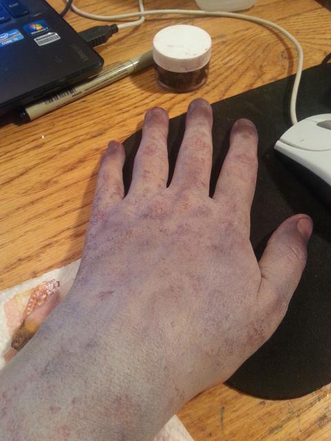 Dead Flesh